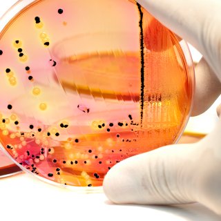 The right antibiotic within an hour: Dutch device promises breakthrough