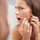 Dr. Pimple Popper: dit zeggen puistjes over je gezondheid