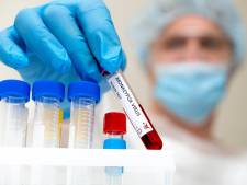 La Belgique compte 757 cas confirmés de variole du singe