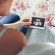 Zwangere vrouwen laten steeds vaker 'echonagels' zetten en zó ziet dat eruit