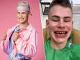 Ziggy Krassenberg in ‘K2 zoekt K3' (links) en Ziggy Krassenberg op TikTok tijdens zijn behandeling in Turkije.