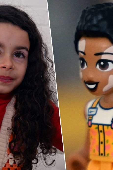"Maman, regarde... C'est moi!": atteinte de vitiligo, Emily est devenue ambassadrice Lego Friends