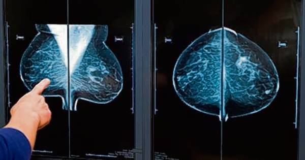 Vanaf 5 december weer borstonderzoek in Leuth