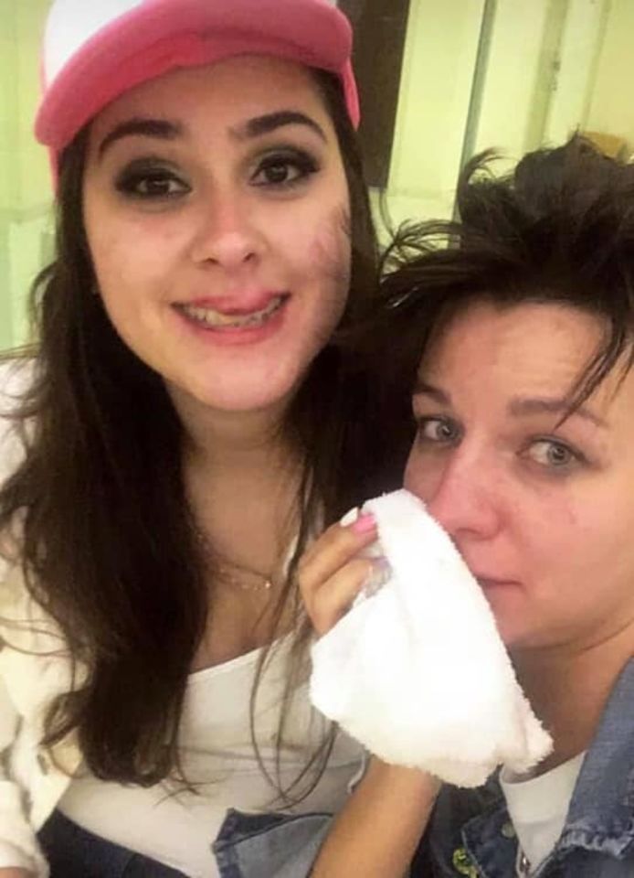Ana Camboim (links) en Katya Sazanova (rechts) liepen onder meer verschillende zwellingen in het gezicht op.