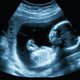 Microplastics ontdekt in placenta’s van ongeboren baby’s