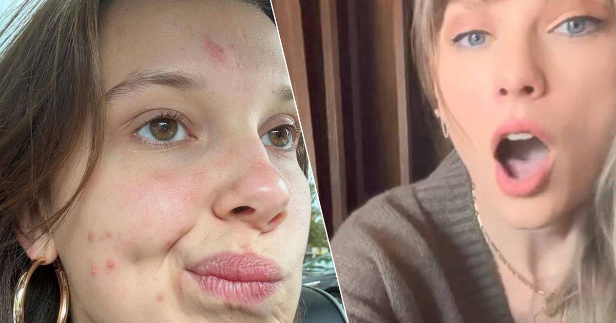 Celebrities 24/7.  Taylor Swift can’t believe how well the ‘old’ hit is doing again and Millie Bobby Brown shows off her acne |  celebrities