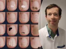 Ce que les taches et fissures sur vos ongles révèlent de votre santé