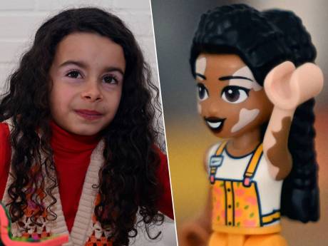 "Maman, regarde... C'est moi!": atteinte de vitiligo, Emily est devenue ambassadrice Lego Friends