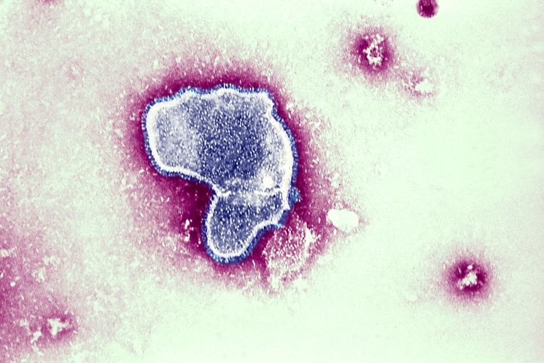 Microscopische opname van het rs-virus. Wereldwijd is dit virus – na malaria – de meest voorkomende oorzaak van zuigelingensterfte. Beeld Getty