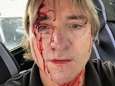 Verkeersagressie in Perth: bestuurder bijna doodgeslagen omdat hij 5 km/uur te traag reed