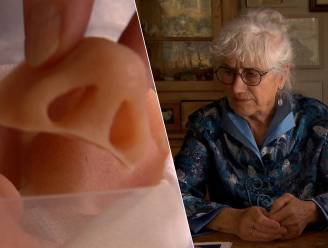 KIJK. Nederlandse Anita draagt al 11 jaar protheses na neusamputatie wegens zeldzame kanker: “Ik heb voorraad zomer- en winterexemplaren”