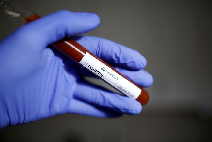 Een buisje met  met het coronavirus besmet bloed.