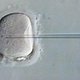 Meer risico op afwijking bij ivf-kind