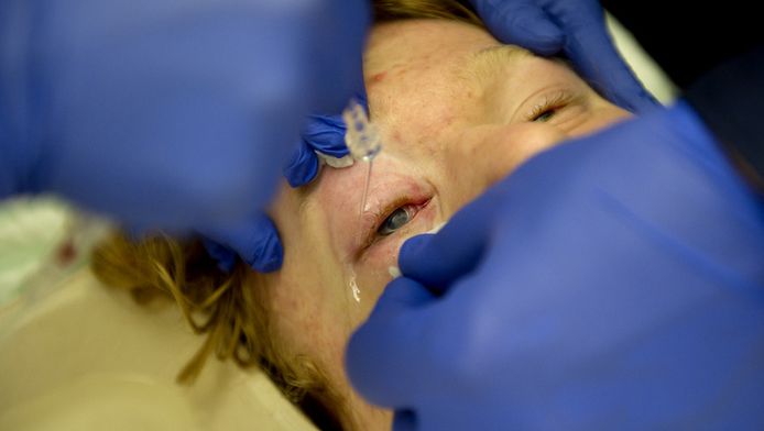 Meer Slachtoffers Vuurwerk Onder Het Mes Binnenland Ad Nl