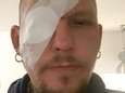 Brian zwaargewond aan oog door over de weg gespannen visdraad: ‘Het bloedde meteen’