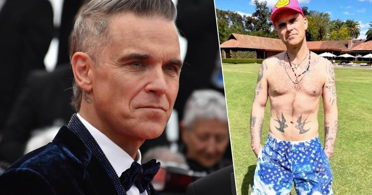 Robbie Williams considers plastic surgery for weight loss results and discusses hair transplant rejections