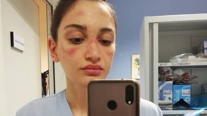Uitgeputte verpleegster ontroert met aangrijpende foto op Instagram: 'Ik ben bang’