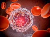 “Zelfs mensen die supergezond leven, kunnen het krijgen”: professor legt uit wat de symptomen van leukemie zijn