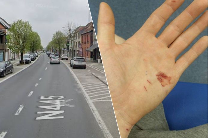 Jordy S. werd vlakbij zijn woning aan de Dendermondsesteenweg in Sint-Amandsberg overvallen en houdt er enkele verwondingen aan zijn hand aan over.
