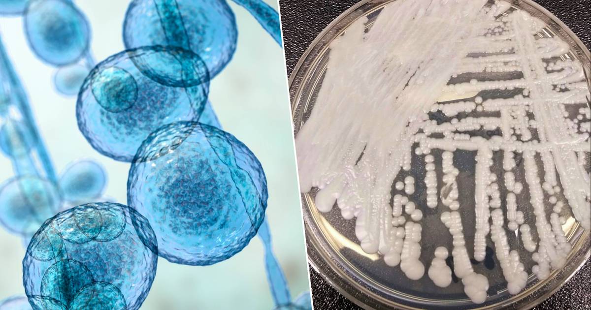 Un institut néerlandais de la santé se prépare à une éventuelle épidémie de champignon ‘candida auris’ |  Sciences & Planète