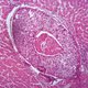 Spreiding kankerdiagnoses in kaart: meer huidkanker in kustgebieden en vaker asbestkanker rond zware industrie