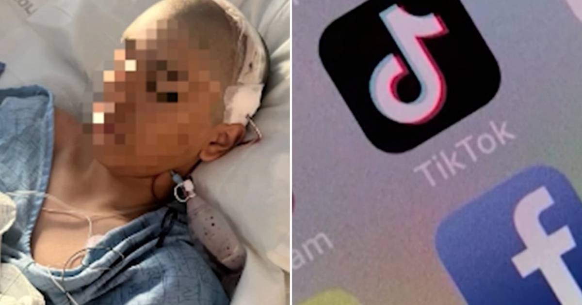 look.  Teenager ends up in hospital with fractured skull after TikTok challenge: ‘The school didn’t intervene’ |  outside