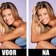 Dossier plastische chirurgie: alles voor een rimpelloos bestaan