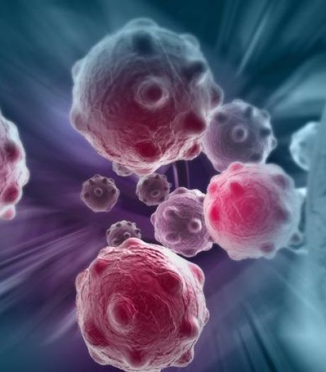 La moitié des cancers du côlon détectée tardivement: “Cette maladie provoque neuf décès par jour en Belgique”