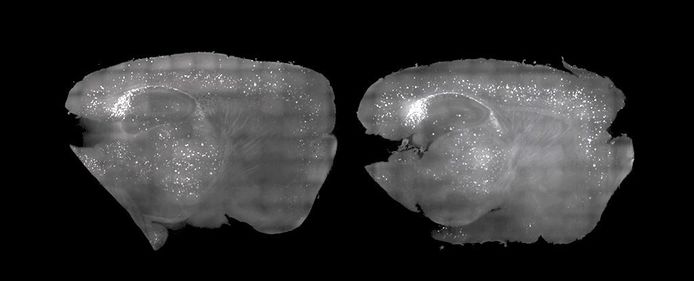 De hersenen van een muis met de behandeling (links) en zonder de behandeling (rechts).