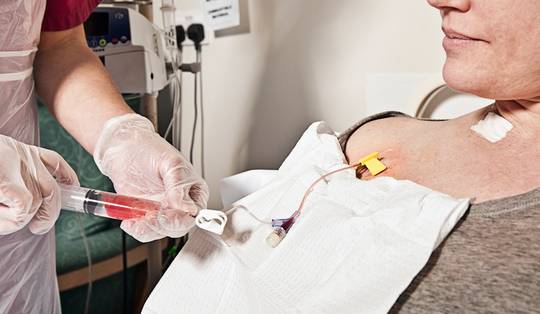 Overlevingskansen stijgen, behalve bij deze twee kankers: wat twintig jaar data ons leren