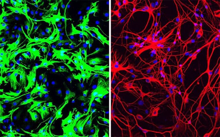 Links: groengekleurde bindweefselcellen in hersenen. Rechts: na genetische ingreep zijn ze veranderd in (roodgekleurde) zenuwcellen. Beeld UC San Diego
