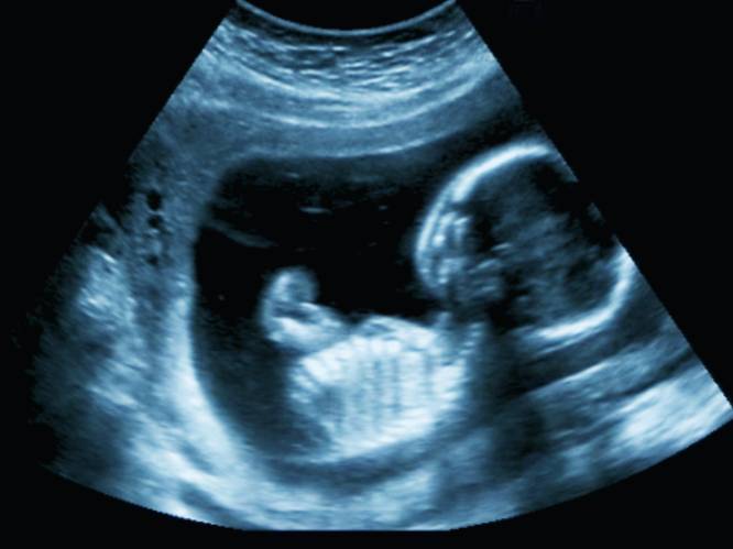 Microplastics ontdekt in placenta's van ongeboren baby's