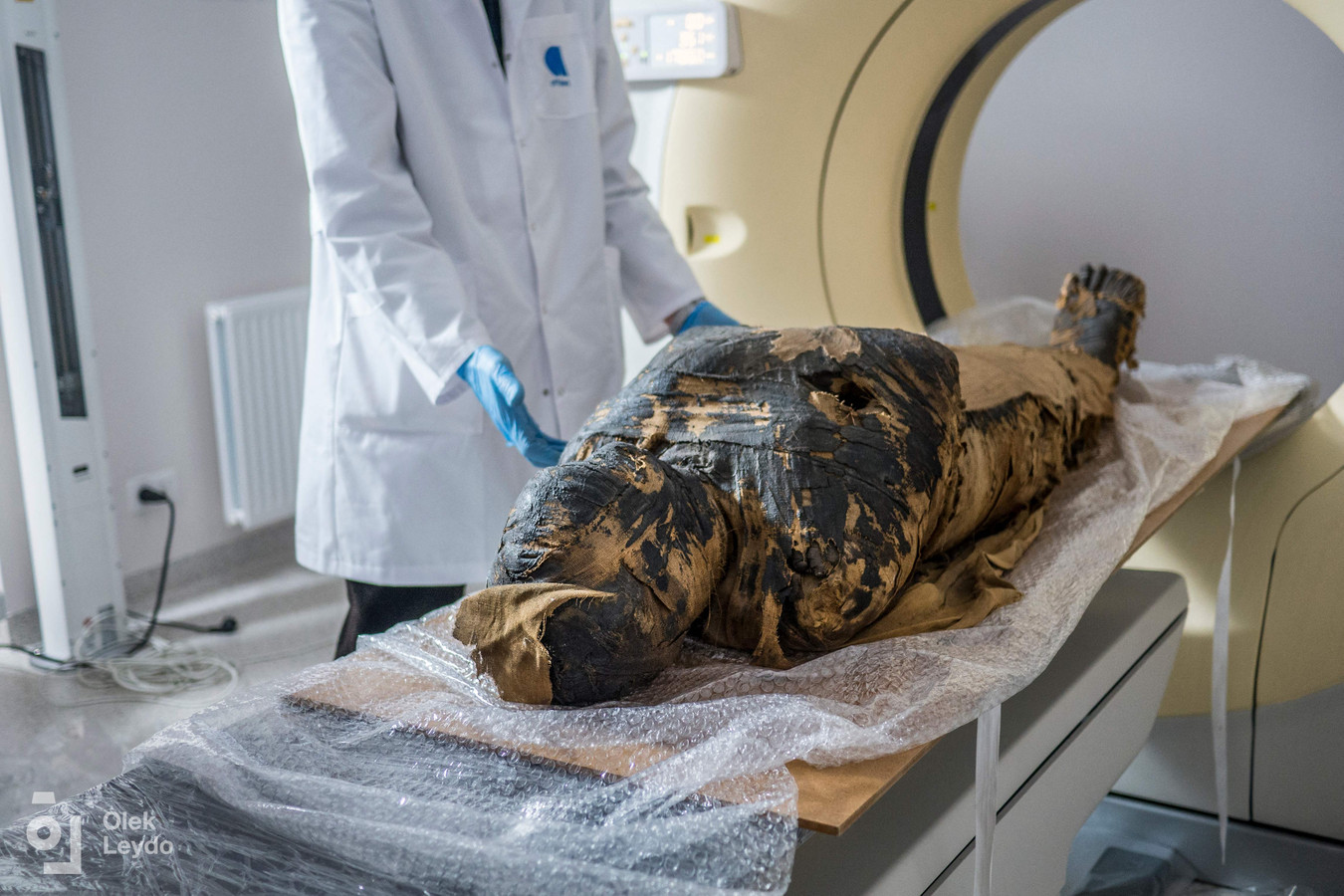 Van de zwangere Egyptische mummie worden röntgenfoto's gemaakt.