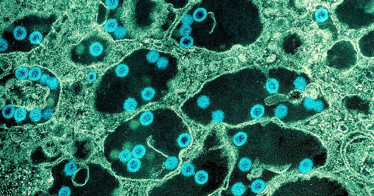 New Virus Found in Peru: Jungle Infection Report