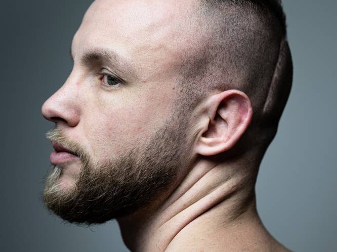 Bij een scan na een knock-out bleek kickbokser Robbie Hageman opeens een hersentumor te hebben