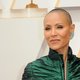 Alopecia-vereniging na beruchte klap van Will Smith: ‘De omgeving moet laten weten dat het oké is om kaal te zijn’
