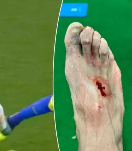 L’intervention rugueuse d’Eden Hazard, fracture du pied pour Akapo