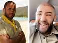 Mohamed de “Koh-Lanta” défiguré après une greffe de cheveux