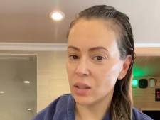 Alyssa Milano partage un étonnant symptôme du coronavirus