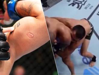 Beet in arm betekent einde van UFC-carrière voor Braziliaanse kooivechter, tegenstander laat afdruk prompt tatoeëren 