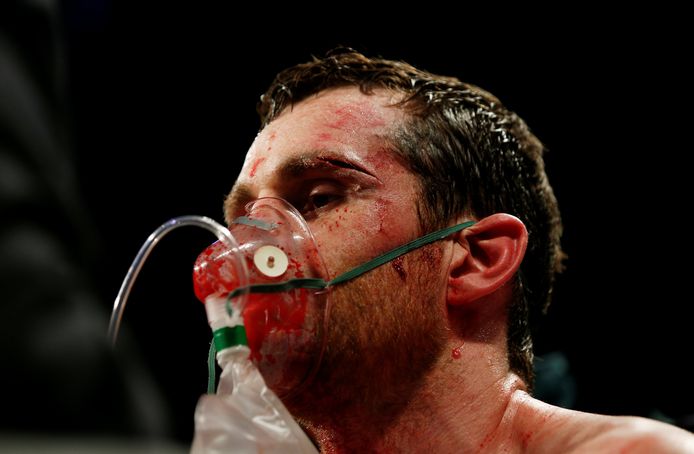 David Price kreeg een zuurstofmasker toegediend na zijn gevecht tegen Alexander Povetkin.