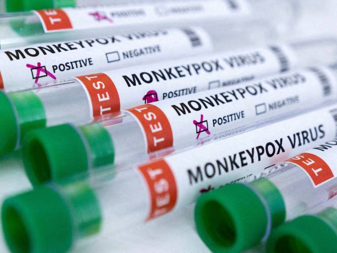 Noemen we apenpokken voortaan MPOX? “WHO wil naam ziekte veranderen vanwege discriminatie”