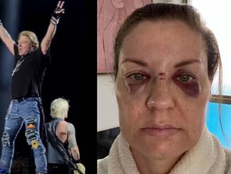 Fan gewond door microfoon Guns N' Roses en haalt uit naar Axl Rose: “Ik had dood kunnen zijn”