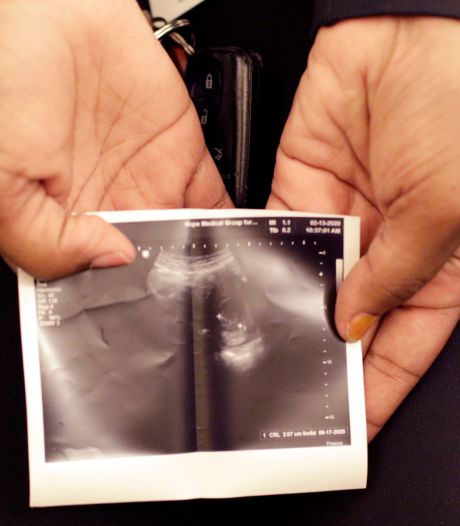 Le Texas prêt à interdire l’immense majorité des avortements