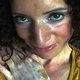 Soraya (37) heeft vitiligo: "Het hoort bij mij en maakt me tot wie ik ben"