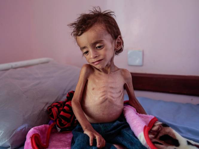 Vergeten conflict: 85.000 kinderen omgekomen van de honger in Jemen in 3 jaar tijd