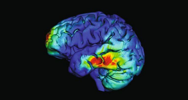 Na stimulering van twee plekken in het brein (warmgekleurd op de afbeelding) bleek het geheugen van oudere mensen beter te werken, volgens het onderzoek van Rob Reinhart en collega's. Beeld R.M.G. REINHART EN J.A. NGUYEN/NATURE NEUROSCIENCE 2019