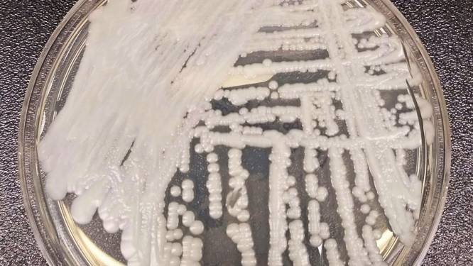 VS bezorgd om potentieel dodelijke schimmel, Nederland houdt een oogje in het zeil
