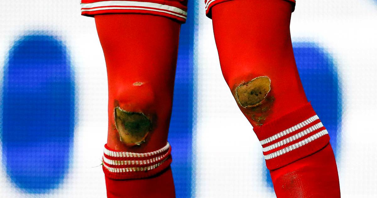 Hoe komen deze gaten in de sokken van Robben? | Time-out ...