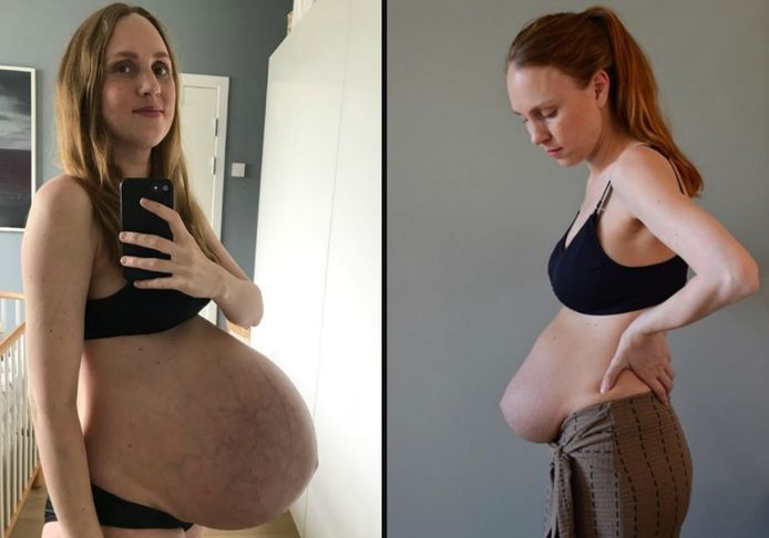 Links: Maria na 35 weken zwangerschap. Rechts ziet u haar vier weken na de bevalling.
